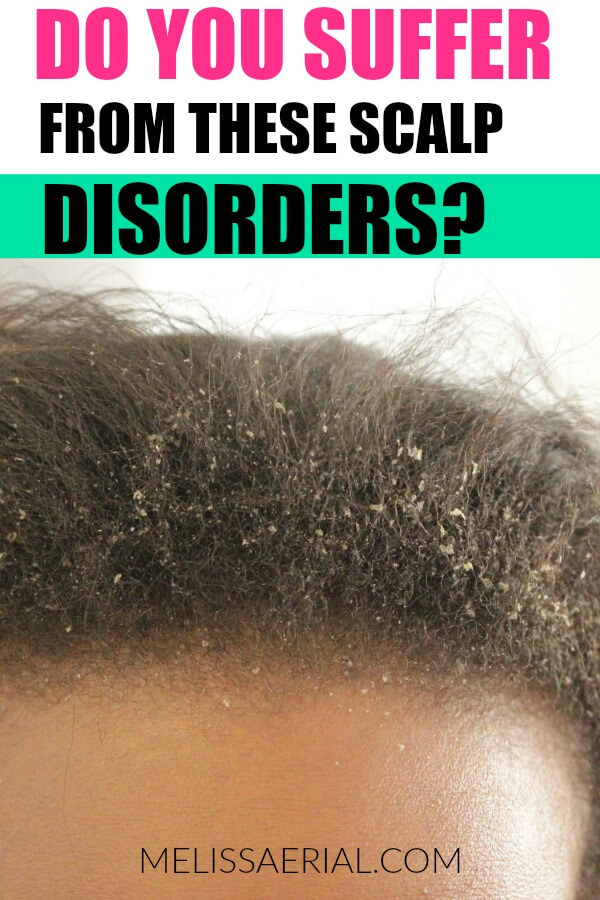 scalp disorders