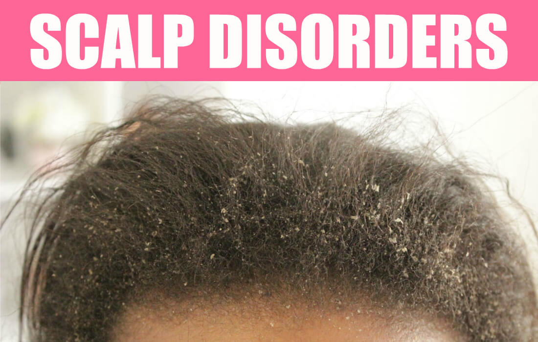 scalp disorders